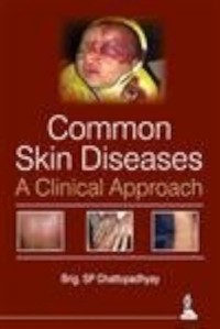 Common Skin Diseases A Clinical Approach